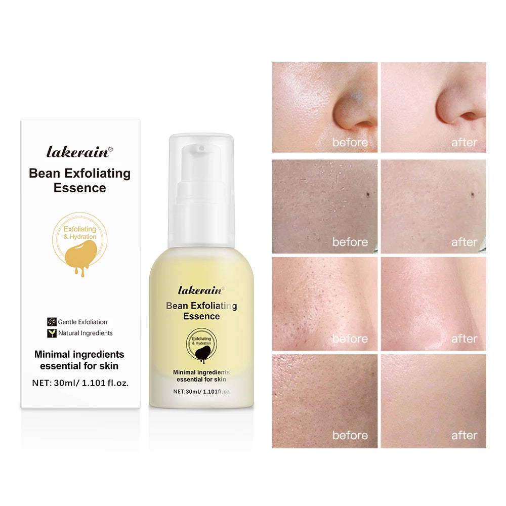 Mixsoon Bean Essence Vegan Snail Facial Exfoliating Essence Facial Moisturizing  Reduce Dead Skin